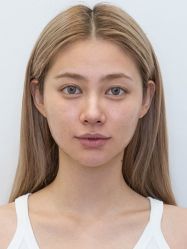 -JustHer宁波珈禾医疗美容医院
