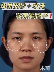 -广州美莱医疗美容医院