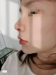 体验后-上海玫瑰医疗美容医院
