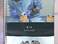 -Andrew指甲专科灰指甲·甲沟炎矫正·3D步态矫形鞋垫定制(上海法华镇路旗舰店)