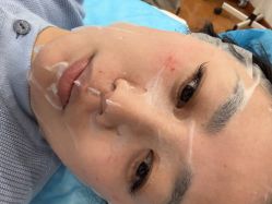 体验后-澳尔颜选医疗美容