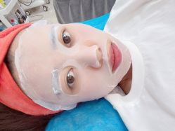 体验后-紫洁俪方（北京）医疗美容