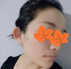 体验前-纯粹医美