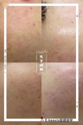 -E.beauty驻颜·痘敏肌调理中心