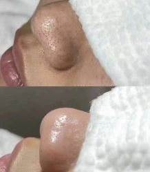 -SKIN79皮肤管理中心