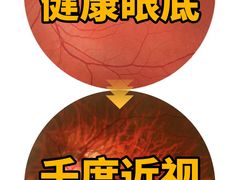 -诺柯视眼镜-蔡司依视路官方工厂店(淞南一店)