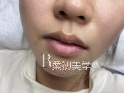 -RC半永久纹眉纹发际线