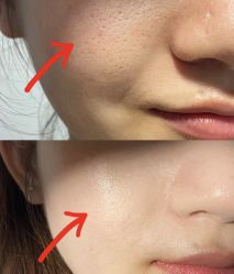 -SKIN79皮肤管理中心