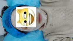 -agge蛋白医美
