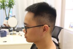 点击看大图 -大麦微针植发丨全国连锁
