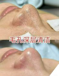 -克丽缇娜