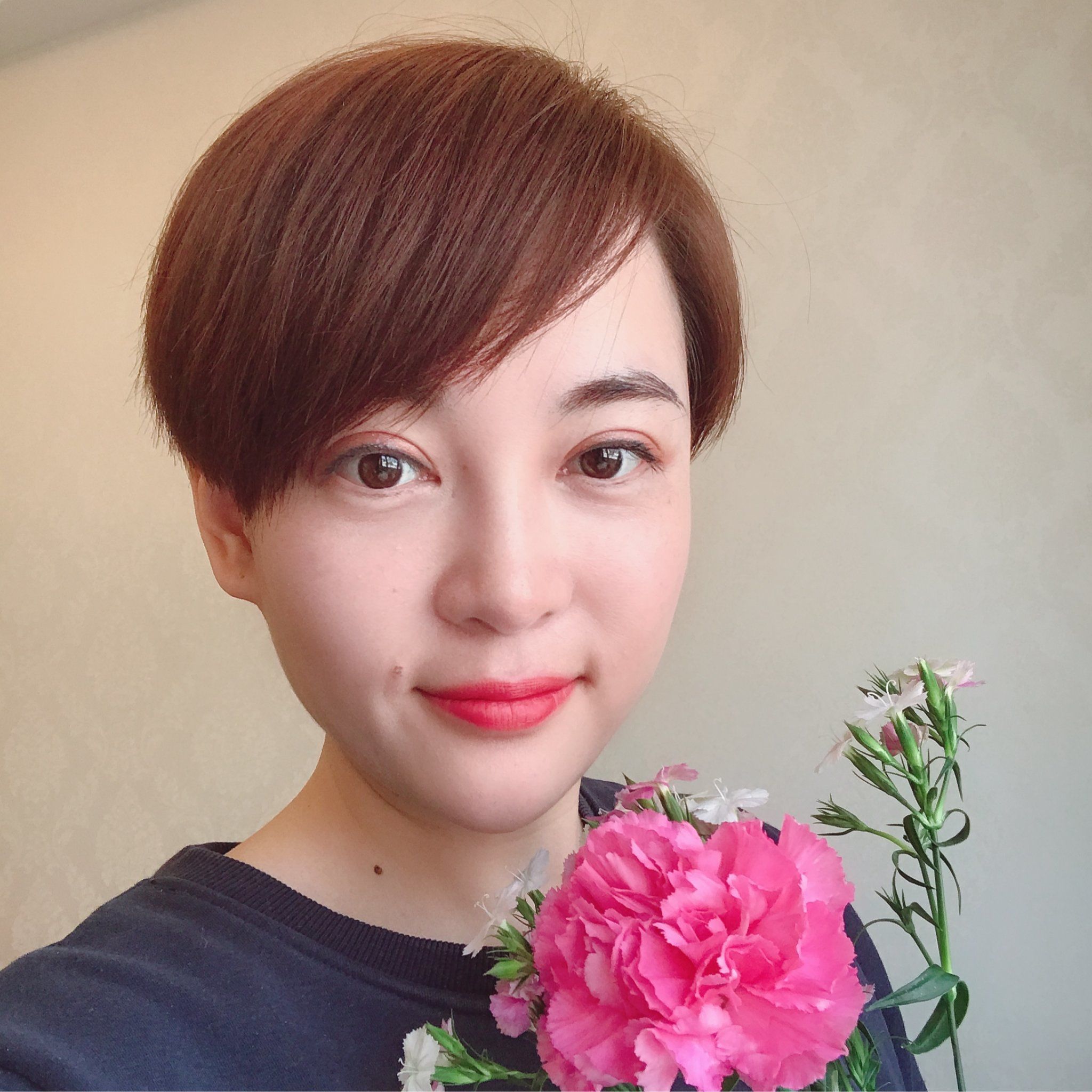 【皮秒 光子嫩肤】体验15天后效果分享