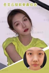 -北京米扬丽格医疗美容·联合丽格鼻整形中心