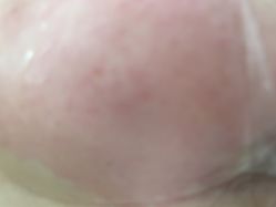 体验后-BR光电保养