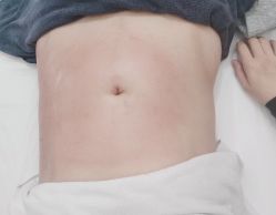 -Lily纤美·科技减脂中心