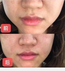 -新美荟医美·专注面部美学抗衰