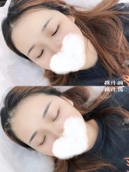 -西施无菌半永久纹绣眉眼影唇轻增发纹发际线