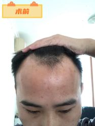 -雍禾植发全国连锁