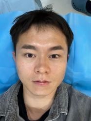 -北京润美玉之光医疗美容