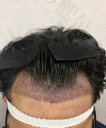 -熙朵美学植发·连锁品牌