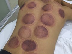 -太乙盲人推拿按摩连锁(星洲店)