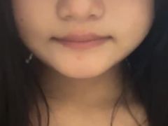 -黑马眼科·近视手术