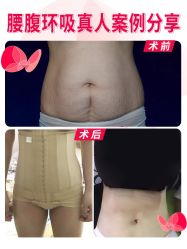 -广东韩妃整形外科医院