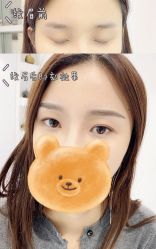 -MIVI半永久纹眉绣眉