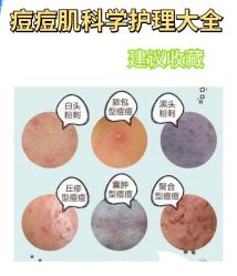 -苗方清颜痘肌研究所