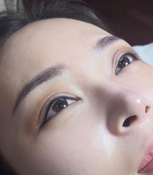体验后-北京英煌医疗美容