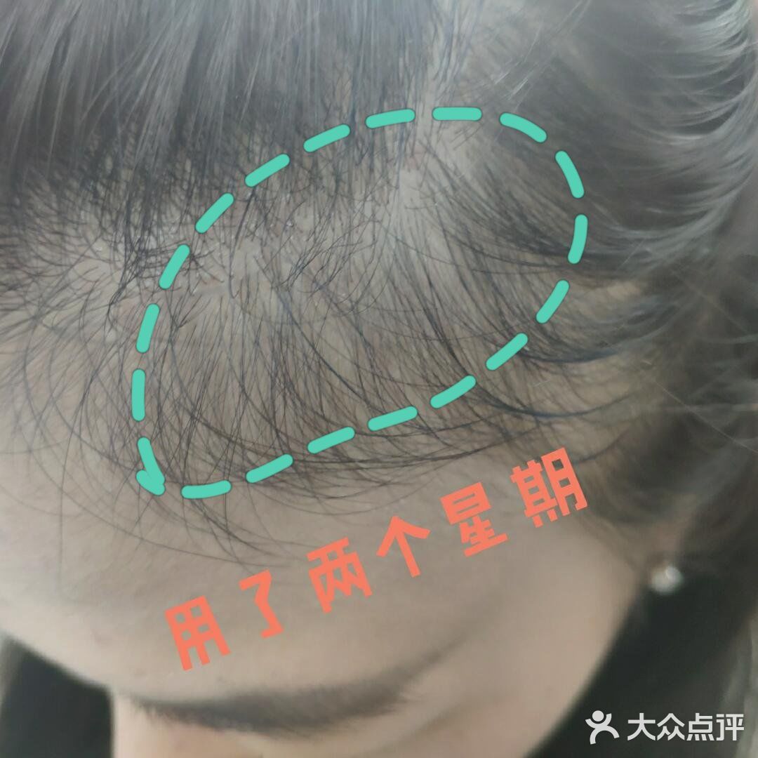 太好用了 谁说生发难的？站出来！ 
