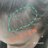 太好用了 谁说生发难的？站出来！ 