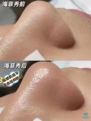 -安吉拉青春化管理中心