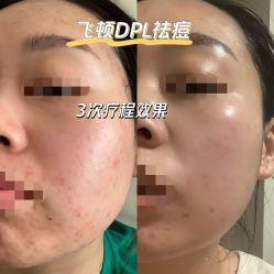 -0 SPA科技美肤·Valmont法儿曼品牌