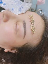 体验后-郡艺医疗美容·微整·眼鼻吸脂