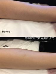 -觅屿日式脱毛美肤