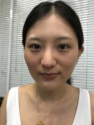 -南宁维密整形·王敦华眼鼻整复中心