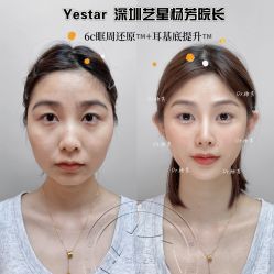 -深圳艺星医疗美容医院