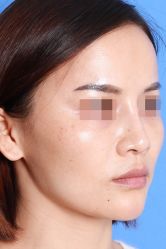 -圣嘉新医疗美容医院