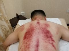 -宜华康盲人按摩(马连洼旗舰店)
