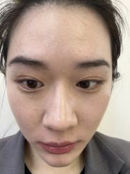 -长沙雅美医疗美容医院