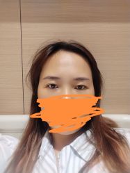 体验前-深圳鹏爱悦心医疗美容医院