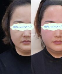 -Yestar重庆艺星医疗美容医院