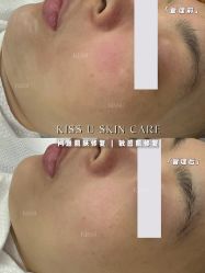 -KISS U 国际美学