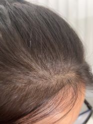 -熙朵美学植发连锁