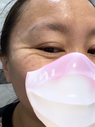 体验前-金圣医疗美容