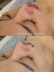 点击看大图 -MLP美丽派·问题肌疗愈中心