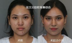 -北京米扬丽格医疗美容·联合丽格鼻整形中心