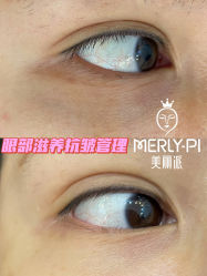 -MLP美丽派·问题肌疗愈中心