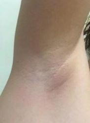 -东莞西妃整形美容医院